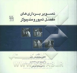 تصویربرداری‌های مفصل تمپورومندیبولار