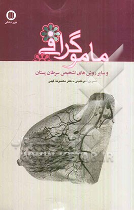 ماموگرافی و سایر روش‌های تشخیص سرطان پستان