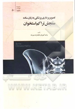 تصویربرداری پزشکی به زبان ساده، سنجش تراکم استخوان