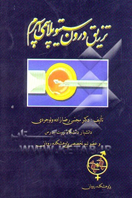 تزریق درون سیتوپلاسمی اسپرم