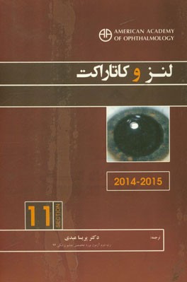 لنز و کاتاراکت (2015-2014)