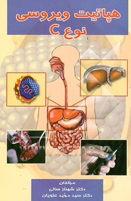 هپاتیت ویروسی نوع "C