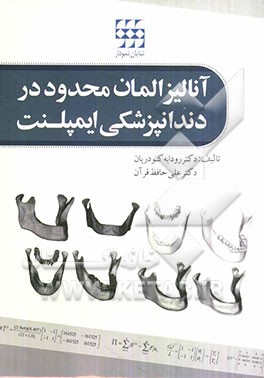 آنالیز المان محدود در دندانپزشکی ایمپلنت