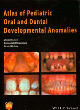 Atlas of pediatric oral and dental developmental anomalies