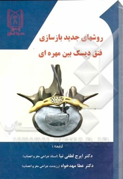 روشهای جدید جهت بازسازی فتق دیسک بین مهره‌ای