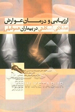 ارزیابی و درمان عوارض عضلانی - اسکلتی در بیماران هموفیلی