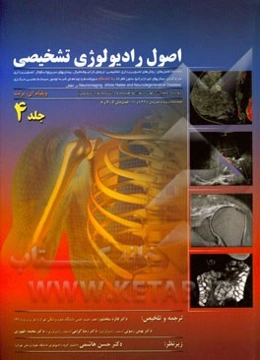 اصول رادیولوژی تشخیصی (ویژه داوطلبان آزمون ارتقاء گواهینامه و دانشنامه بورد تخصصی): روش‌های تصویربرداری تشخیصی، ترومای کرانیوفاشیال، ...