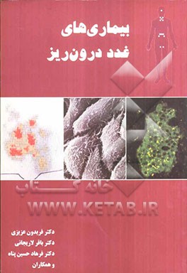 بیماری‌های غدد درون‌ریز