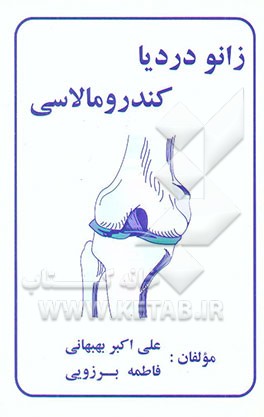 زانو درد، یا، کندرو مالاسی