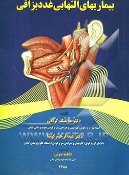 بیماریهای التهابی غدد بزاقی