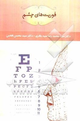 فوریت‌های چشم