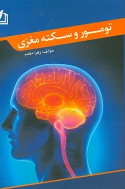 تومور و سکته مغزی