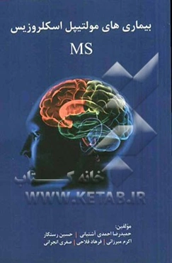 بیماری مولتیپل اسکلروزیس