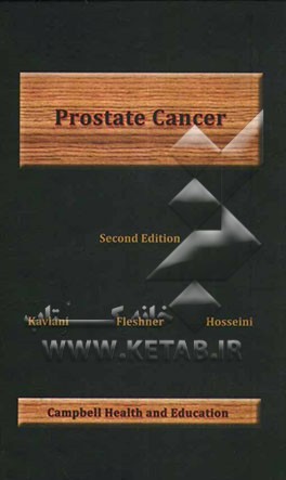 Prostate cancer