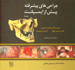 جراحی‌های پیشرفته پیش از ایمپلنت