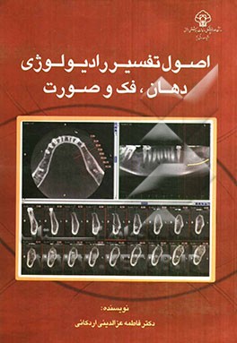 اصول تفسیر رادیولوژی دهان، فک و صورت