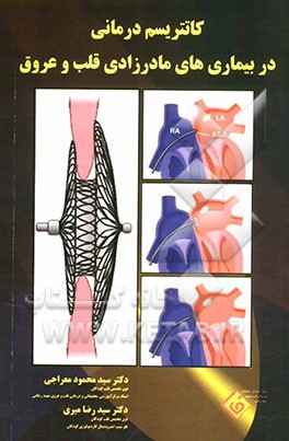 کاتتریسم‌درمانی در بیماریهای مادرزادی قلب و عروق