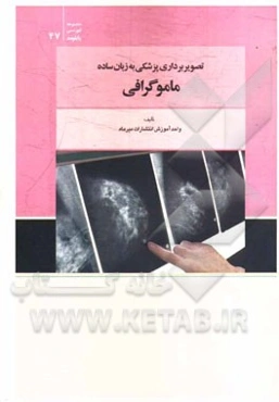 تصویربرداری پزشکی به زبان ساده، ماموگرافی