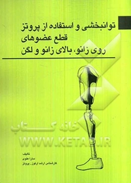 توانبخشی و استفاده از پروتز قطع عضوهای روی زانو، بالای زانو و لگن