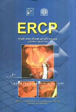 ERCP (ای. آر. سی. پی.)