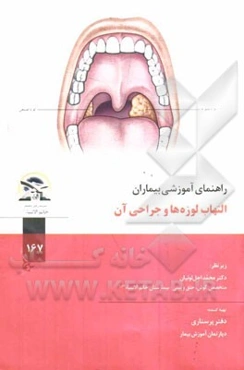 التهاب لوزه‌ها و جراحی آن