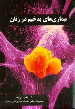 بیماری‌های بدخیم در زنان