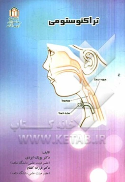 تراکئوستومی