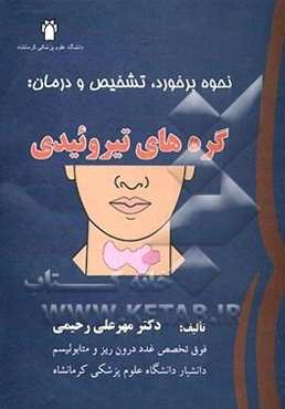 نحوه برخورد، تشخیص و درمان: گره‌های تیروئیدی