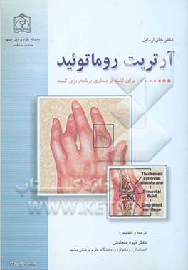 آرتریت روماتوئید: برای غلبه بر بیماری برنامه‌ریزی کنید