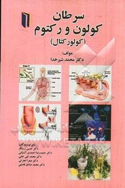 سرطان کولون و رکتوم (کولورکتال)