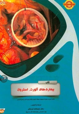 قلب: بیماری‌های آئورت، استروک: خلاصه درس به همراه مجموعه سوالات آزمون ارتقاء و بورد قلب با پاسخ تشریحی Braunwald 2015
