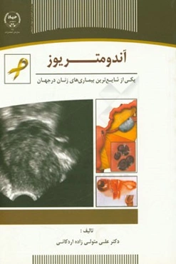 آندومتریوز یکی از شایع‌ترین بیماری‌های زنان در جهان