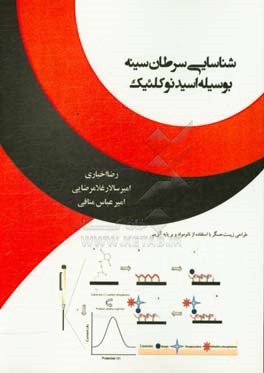 شناسایی سرطان سینه بوسیله اسیدنوکلئیک
