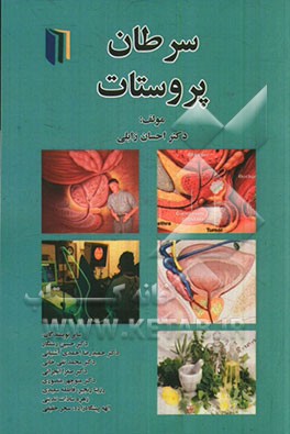 سرطان پروستات