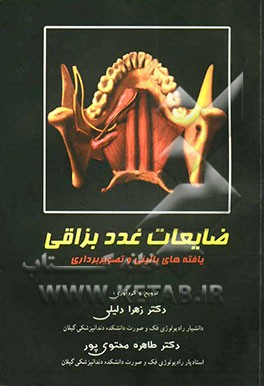 ضایعات غدد بزاقی: یافته‌های بالینی و تصویربرداری
