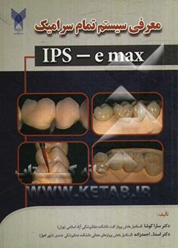 معرفی سیستم تمام سرامیک IPS - e max