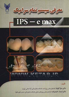 معرفی سیستم تمام سرامیک IPS - e max