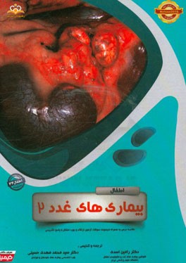 اطفال: بیماری‌های غدد 2: خلاصه درس به همراه مجموعه سوالات آزمون ارتقاء و بورد اطفال با پاسخ تشریحی Nelson 2016