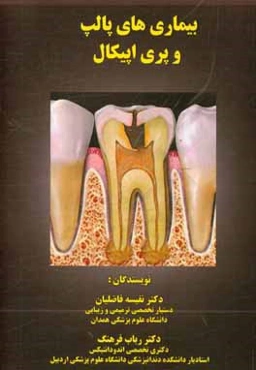 بیماری‌های پالپ و پری اپیکال