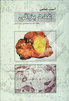 آسیب‌شناسی غدد بزاقی