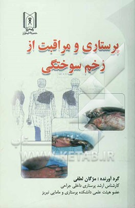 پرستاری و مراقبت از زخم سوختگی