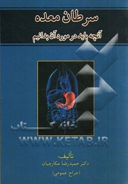 سرطان معده "آنچه باید در مورد آن بدانیم"