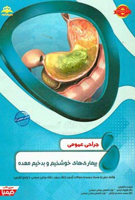 جراحی عمومی: بیماری‌های خوش‌خیم و بدخیم معده: خلاصه درس به همراه مجموعه سوالات آزمون ارتقاء و بورد جراحی عمومی با پاسخ تشریحی