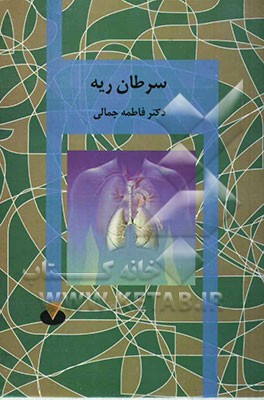 سرطان ریه