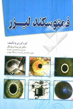 فمتوسکند لیزر