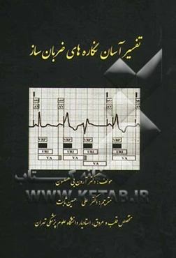 تفسیر آسان نگاره‌های ضربان ساز