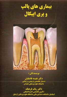 بیماری‌های پالپ و پری اپیکال