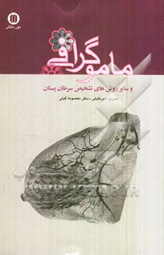 ماموگرافی و سایر روش‌های تشخیص سرطان پستان