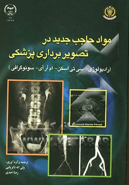 مواد حاجب جدید در تصویربرداری پزشکی (رادیولوژی - CT اسکن - MRI - سونوگرافی