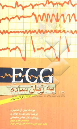 ECG به زبان ساده